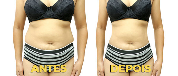 slide1-antes-depois