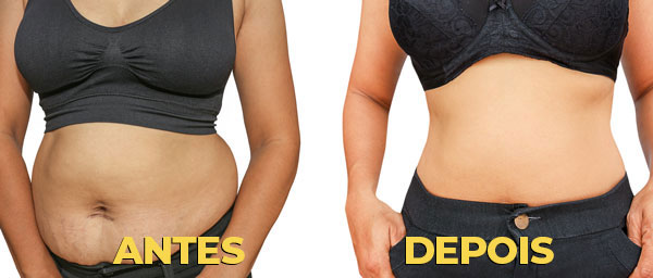 slide3-antes-depois